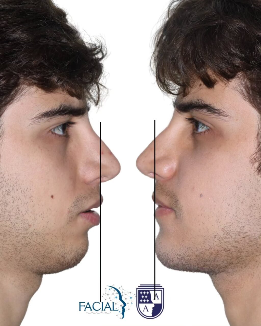 Instagram post from drantonioalbuquerque. This post is in position 1.