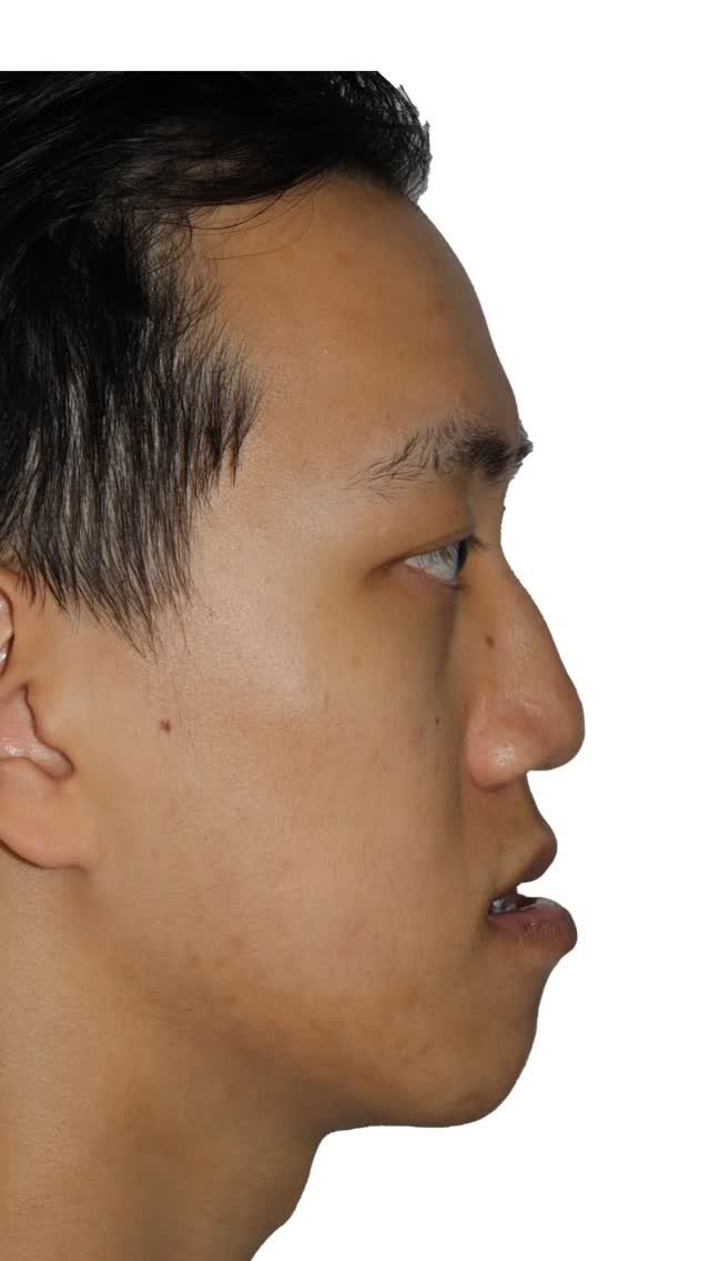 Instagram post from drantonioalbuquerque. This post is in position 7.